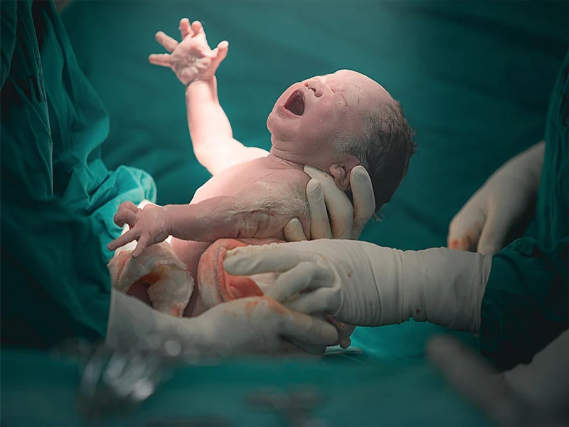 OPD | Normal | Cesarean Delivery & Surgical 